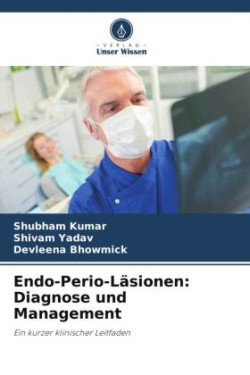 Endo-Perio-Läsionen: Diagnose und Management