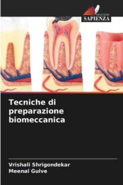 Tecniche di preparazione biomeccanica