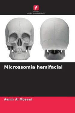 Microssomia hemifacial