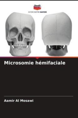 Microsomie hémifaciale