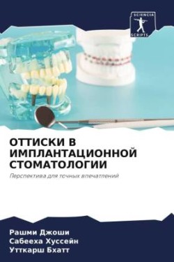 ОТТИСКИ В ИМПЛАНТАЦИОННОЙ СТОМАТОЛОГИИ