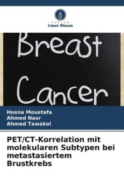 PET/CT-Korrelation mit molekularen Subtypen bei metastasiertem Brustkrebs