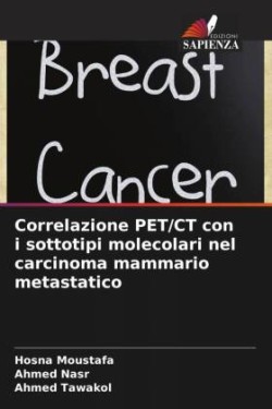 Correlazione PET/CT con i sottotipi molecolari nel carcinoma mammario metastatico