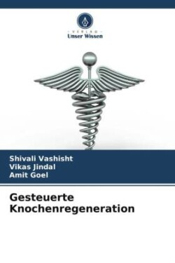 Gesteuerte Knochenregeneration