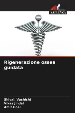 Rigenerazione ossea guidata