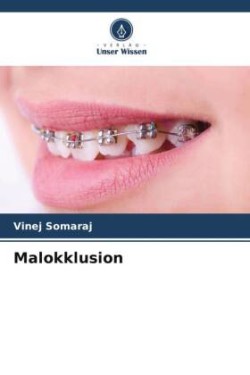 Malokklusion