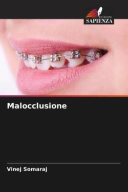 Malocclusione