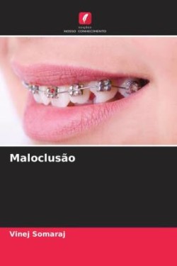 Maloclusão