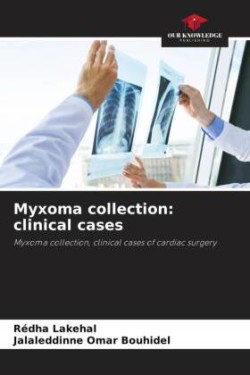 Myxoma collection