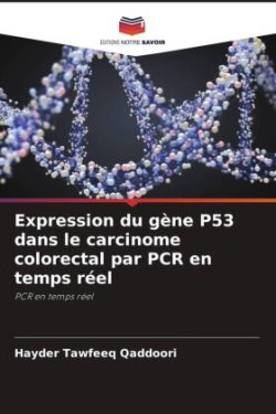 Expression du gène P53 dans le carcinome colorectal par PCR en temps réel