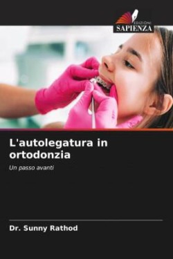 L'autolegatura in ortodonzia