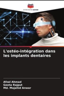 L'ostéo-intégration dans les implants dentaires