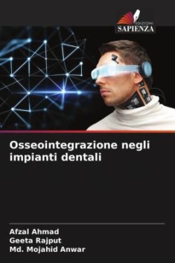 Osseointegrazione negli impianti dentali