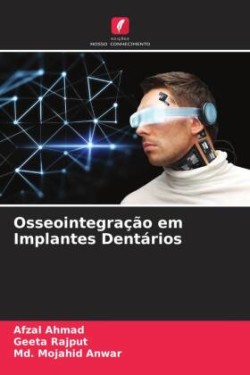 Osseointegração em Implantes Dentários