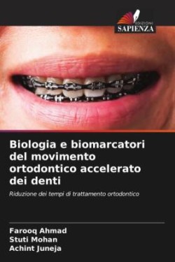 Biologia e biomarcatori del movimento ortodontico accelerato dei denti