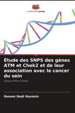 Étude des SNPS des gènes ATM et Chek2 et de leur association avec le cancer du sein