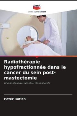 Radiothérapie hypofractionnée dans le cancer du sein post-mastectomie