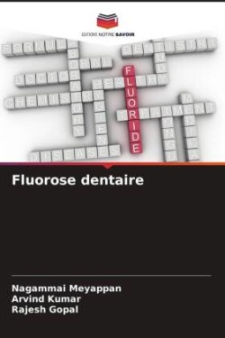 Fluorose dentaire