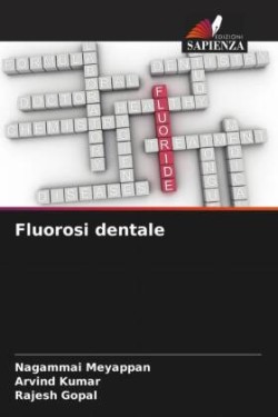 Fluorosi dentale