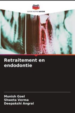 Retraitement en endodontie