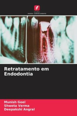 Retratamento em Endodontia