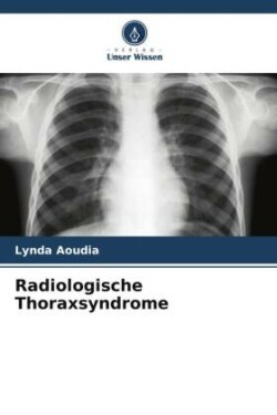 Radiologische Thoraxsyndrome