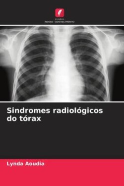 Sindromes radiológicos do tórax