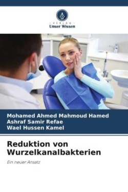 Reduktion von Wurzelkanalbakterien