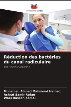 Réduction des bactéries du canal radiculaire