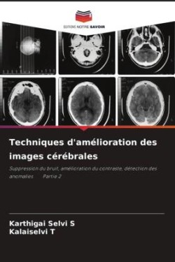 Techniques d'amélioration des images cérébrales