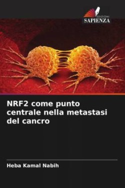 NRF2 come punto centrale nella metastasi del cancro