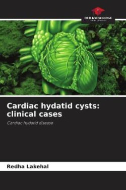 Cardiac hydatid cysts