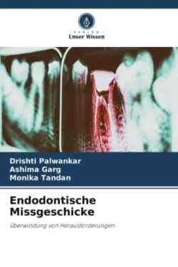 Endodontische Missgeschicke