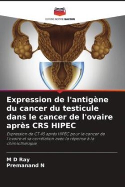 Expression de l'antigène du cancer du testicule dans le cancer de l'ovaire après CRS HIPEC