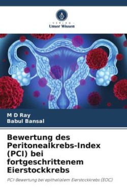 Bewertung des Peritonealkrebs-Index (PCI) bei fortgeschrittenem Eierstockkrebs