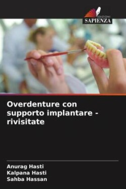 Overdenture con supporto implantare - rivisitate