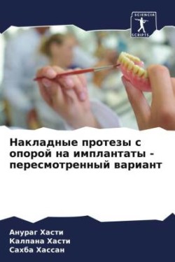 Накладные протезы с опорой на имплантаты - &#1