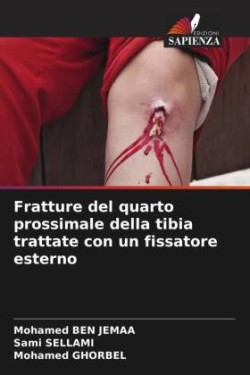 Fratture del quarto prossimale della tibia trattate con un fissatore esterno