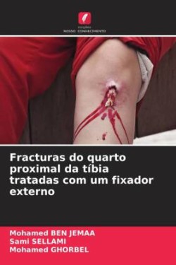 Fracturas do quarto proximal da tíbia tratadas com um fixador externo