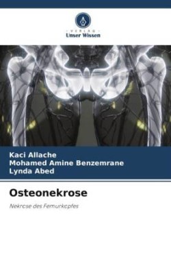 Osteonekrose