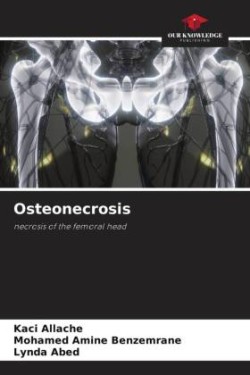 Osteonecrosis