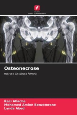 Osteonecrose