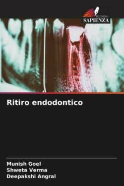 Ritiro endodontico