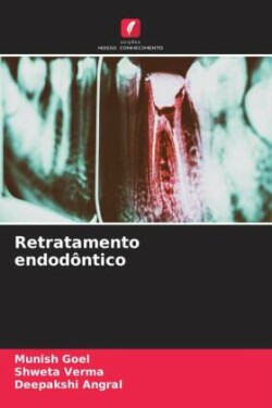 Retratamento endodôntico