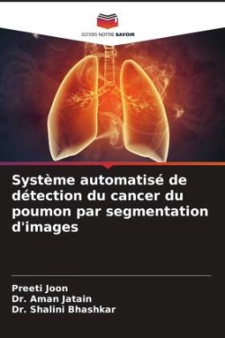 Système automatisé de détection du cancer du poumon par segmentation d'images