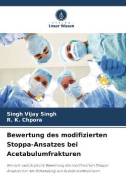 Bewertung des modifizierten Stoppa-Ansatzes bei Acetabulumfrakturen