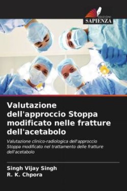 Valutazione dell'approccio Stoppa modificato nelle fratture dell'acetabolo