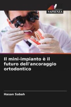 mini-impianto è il futuro dell'ancoraggio ortodontico