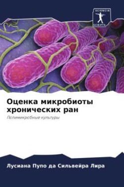 Оценка микробиоты хронических ран