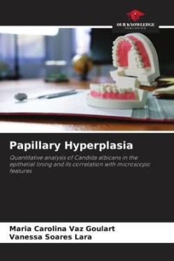 Papillary Hyperplasia